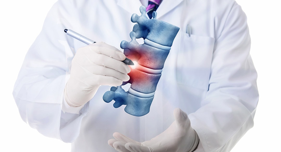 endoscopiadecolumna